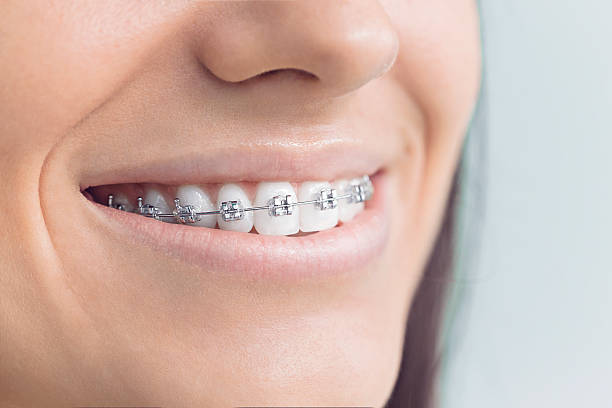  Meridian, TX Dental Services Pros